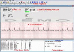 Diagnose-Software - Reviewer - Vmed Technology - Elektrokardiografie / für Tierarztpraxis