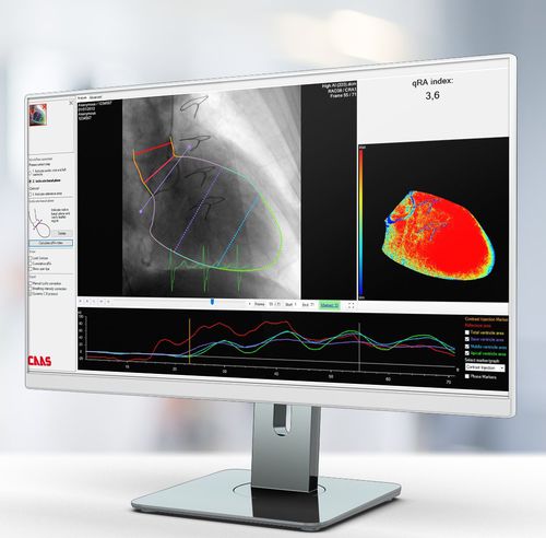 Medizinische Software - Pie Medical Imaging - für medizinische Bildgebung / Kardiologie / Bildanalyse