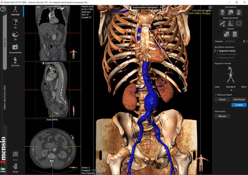 Medizinische Software - 3mensio Vascular - Pie Medical Imaging - TDM ...