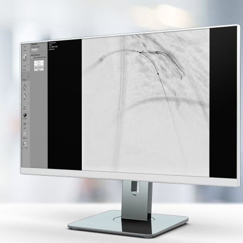 Medizinische Software - StentEnhancer - Pie Medical Imaging - Kardiologie / zur Bildverbesserung / Visualisierung