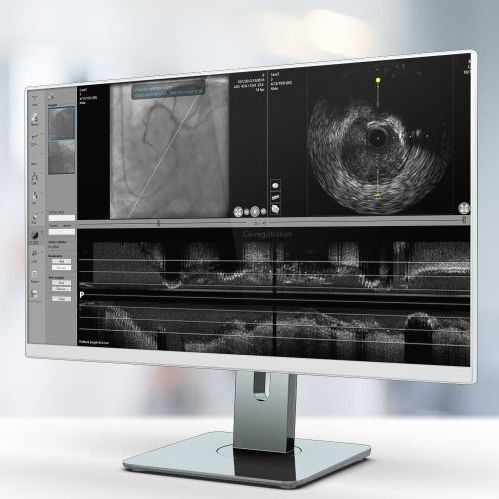 Angiographie-Software - IV-LINQ - Pie Medical Imaging - Visualisierung / für Tablet-PC