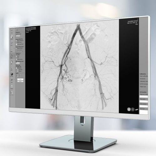 Angiographie-Software - QVA - Pie Medical Imaging - Kardiologie / Analyse / Reporting