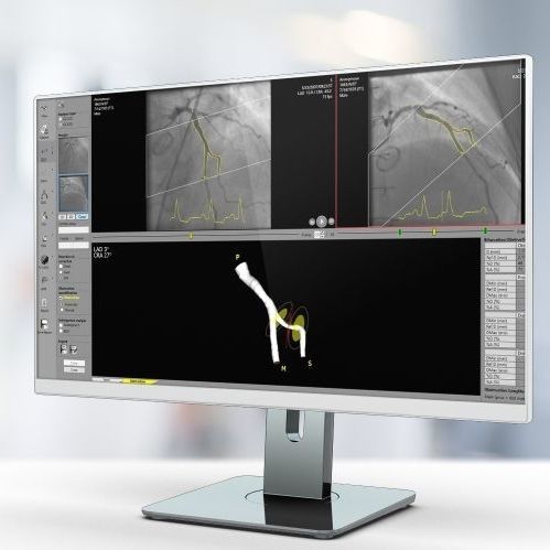 Software für medizinische Bildgebung - QCA  - Pie Medical Imaging - für Kardiologie / Analyse / Reporting
