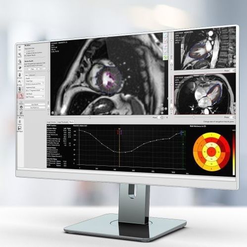Medizinische Software - Pie Medical Imaging - MRT / für Kardiologie / Analyse