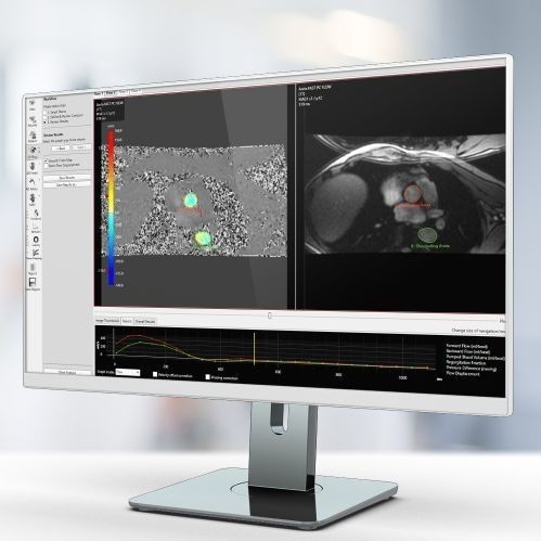 Analysesoftware - Pie Medical Imaging - Reporting / Visualisierung / Inspektion