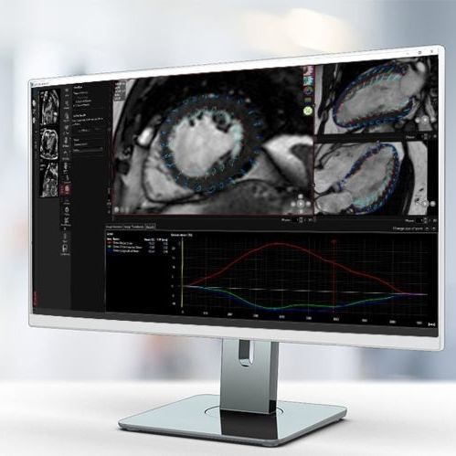 Medizinische Software - MR Strain - Pie Medical Imaging - für Kliniken / MRT / für Kardiologie