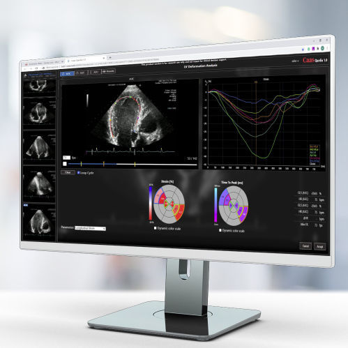 Medizinische Software - Qardia - Pie Medical Imaging - für Kliniken / für Ultraschalluntersuchungen / für Echokardiographie
