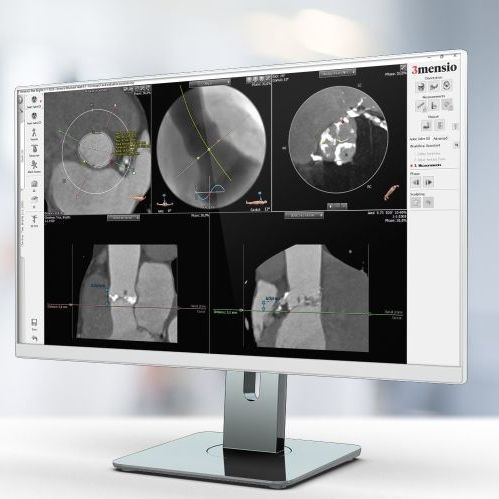 Medizinische Software - Pie Medical Imaging - Computertomographie / für Kardiologie / Analyse