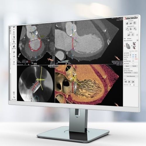 Medizinische Software - Pie Medical Imaging - Computertomographie / für Kardiologie / Analyse