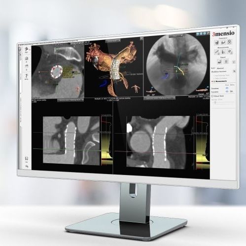 Software für Krankenhaus - Pie Medical Imaging - Reporting / Planung / Umform