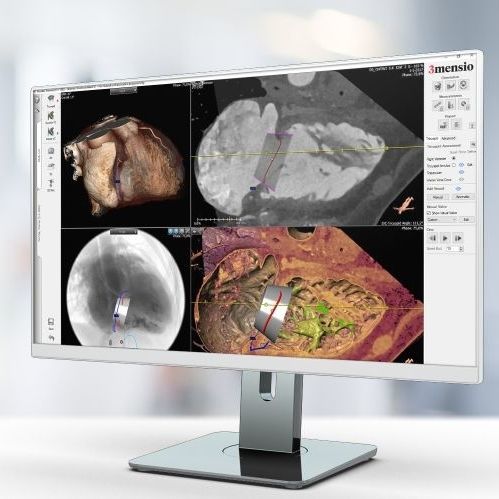 Medizinische Software - Pie Medical Imaging - Bildanalyse / Reporting / Import