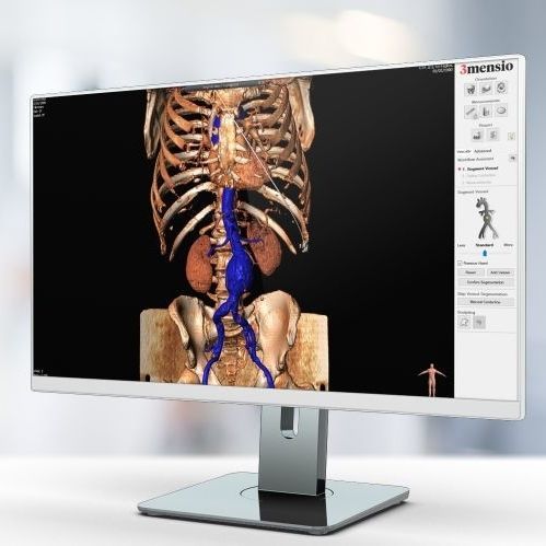 Medizinische Software - Pie Medical Imaging - Computertomographie / für PACS / für DCIM-Datei