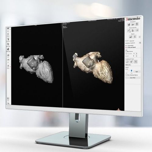Computertomographie-Software - Pie Medical Imaging - für Forschungszwecke / Erfassung / 3D-Druck