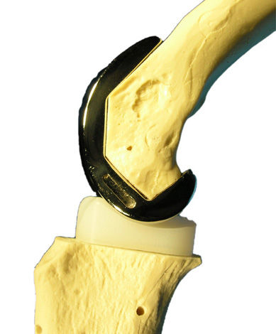 Veterinr-Knieprothese / fr Hunde - TKR - Biomedtrix - fr  Totalarthroplastik des Knies