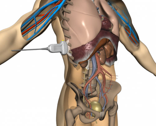 Patientensimulator für Ultraschalluntersuchungen - ICCU - Elevate Healthcare - für klinische Behandlungen / für Intensivpflege / Arbeitsstation