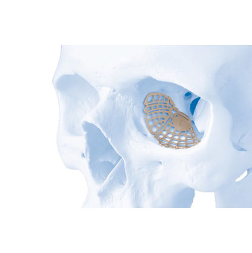 Nicht resorbierbares Orbitalimplantat - MatrixORBITAL™ - Depuy Synthes