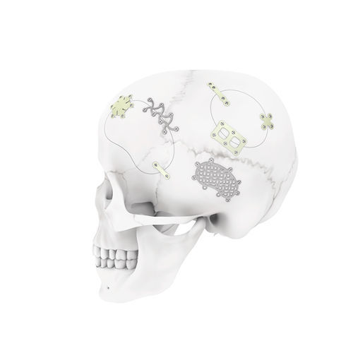 Nicht resorbierbares Schädelfixierungssystem - MatrixNEURO™ - Depuy Synthes