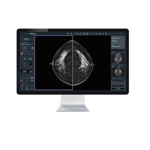 Software für zellulare Bildgebung - RConsole2 : AIDIA - DRTECH - für Mammographie / Bildanalyse / Management