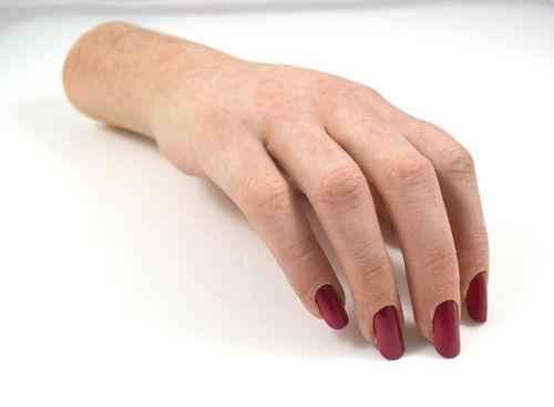 Kosmetische Handprothese - Protunix - für Erwachsene