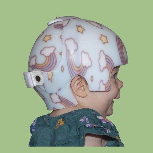 Schädel-Orthese - STARband Bi-Valve - Orthomerica - für Kinder