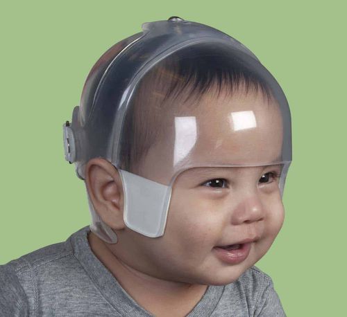 Schädel-Orthese - STARlight™  Bi-Valve  - Orthomerica - für Kinder