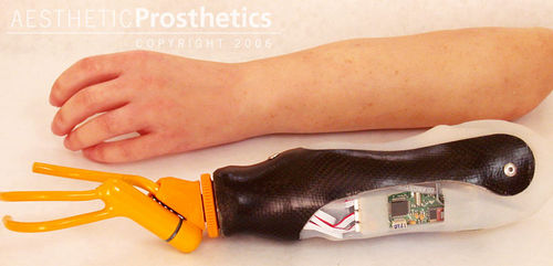Myoelektrische Handprothese - Aesthetic Prosthetics - Hoo / für Erwachsene