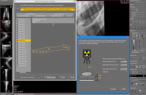 Software-Modul / Planung - dicomPACS® vet Prosthesis  - OR Technology - Oehm und Rehbein - für orthopädische Chirurgie / für Veterinärmedizin