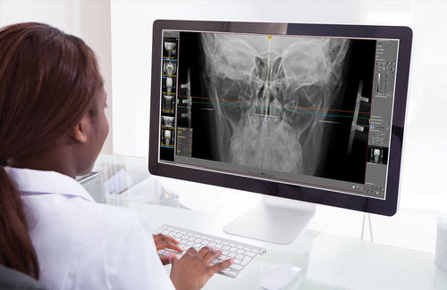 Diagnose-Software - dicomPACS®  - OR Technology - Oehm und Rehbein - Planung / Umform / für Chiropraktik