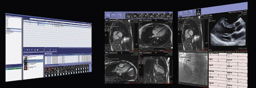 Software für Kliniken - iNteract™ + ¡Review - TeraRecon - für medizinische Bildgebung / Content-Sharing / Diagnose