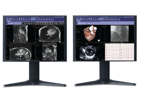 Onkologie-Software - iNtuition REVIEW - TeraRecon - für kardiovaskuläre Chirurgie / für medizinische Bildgebung / 3D-Visualisierung