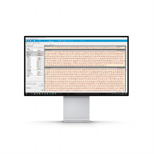 Web-Anwendung / Bildanalyse - Cellavision AB - Visualisierung / Diagnose / medizinisch