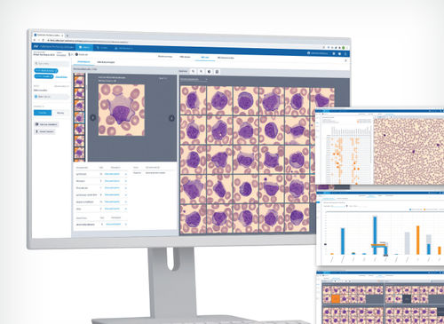 Medizinische Software - Cellavision AB - Labor / Bildanalyse / Management