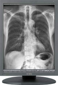 Medizinisch Monitor - MS35i2 - TOTOKU - Diagnose / Mammographie / LCD
