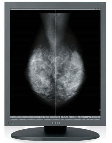 Medizinisch Monitor - MS55i2 - TOTOKU - Mammographie / hochauflösend / LCD