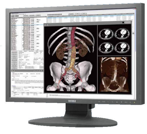 Monitor für medizinische Bildgebung - CCL242 - TOTOKU - 24" / LCD / mit LED-Hintergrundbeleuchtung