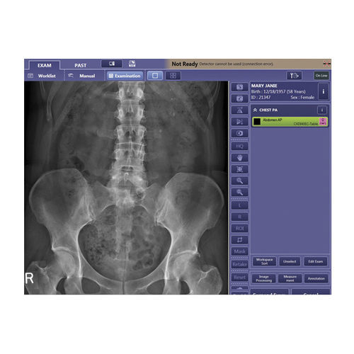 Bildanalyse-Software - CXDI  - Canon Medical System U.S.A - Steuerung / Visualisierung / Beschaffung