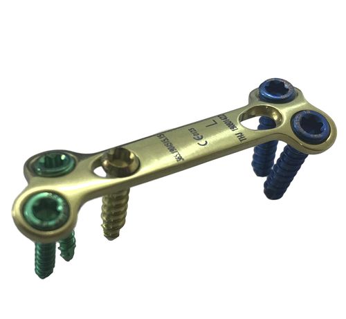 Arthrodeseplatte für Metatarsalknochen - HJ-VA-LOC 06 - Health-Joy Medical - mit Verriegelung / Titan