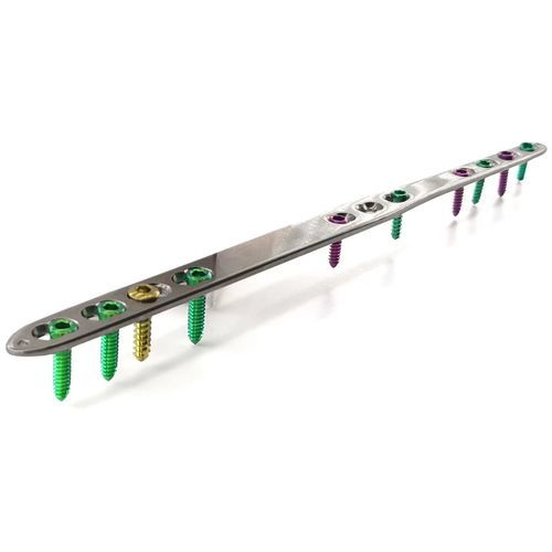 Arthrodeseplatte für Handgelenk - HJ-Small Dorsal Spanning - Health-Joy Medical - für Handwurzelknochen / für Fingerglied / für Fingergrundgelenk