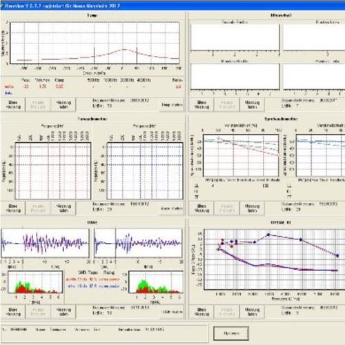 Messsoftware - Overview 4000 - Homoth Medizinelektronik - Navigation / medizinisch / Windows