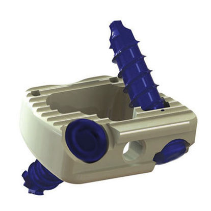 HWS-Zwischenwirbelimplantat - STACC™ - Elite Surgical - ventraler Zugang / aus PEEK