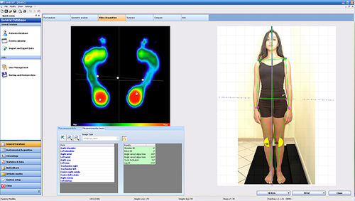 Analysesoftware - Sensor Medica - Podologie