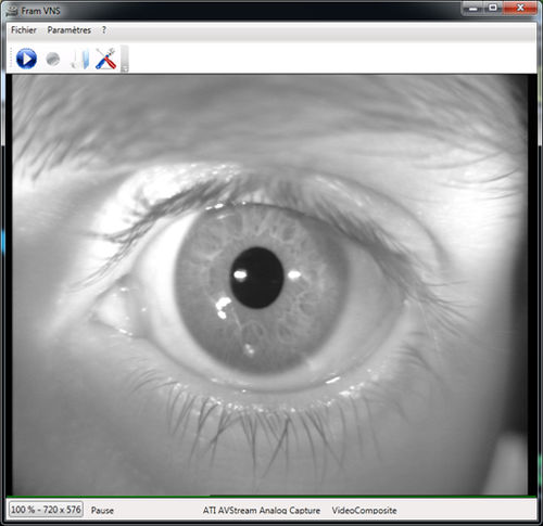 Videoaufnahmesoftware - FRAMVIDEO - Framiral - medizinisch / Videoaufnahme