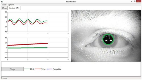 Erfassungssoftware - Framiral - medizinisch / Auge / Kopf