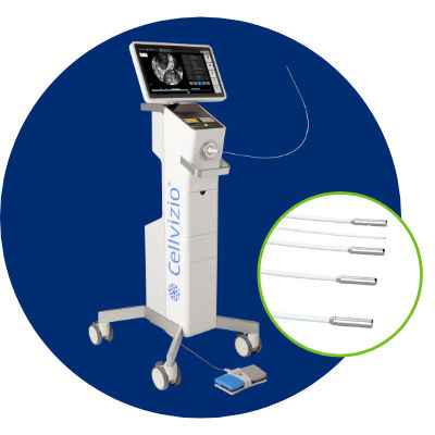 Endoskopisches Abbildungssystem / CLE - CELLVIZIO®  - Mauna Kea Technologies - Bronchoskopie
