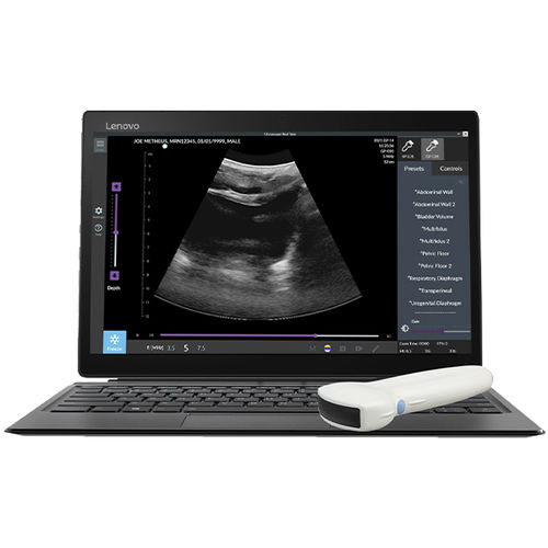 Tragbares Ultraschallgerät - (TUI-S-T) Pathway® US  - The Prometheus Group - für bildgebende Ultraschalldiagnostik im Bauch- und Beckenbereich / Schwarz-Weiß / Farbdoppler