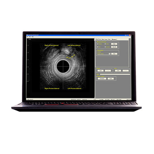 Tragbares Ultraschallgerät - (RTCU-S-N) Morpheus® 360° Endocavity US  - The Prometheus Group - für Ultraschalldiagnostik in Gynäkologie und Geburtshilfe / für kolorektale Diagnostik / Schwarz-Weiß
