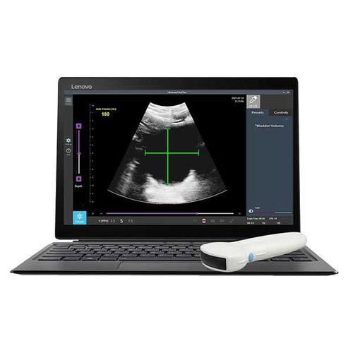 Ultraschall-Handgerät - RTBU-S-T  - The Prometheus Group - für urologische Diagnostik / Schwarz-Weiß / bildgebende Allzwecksonde