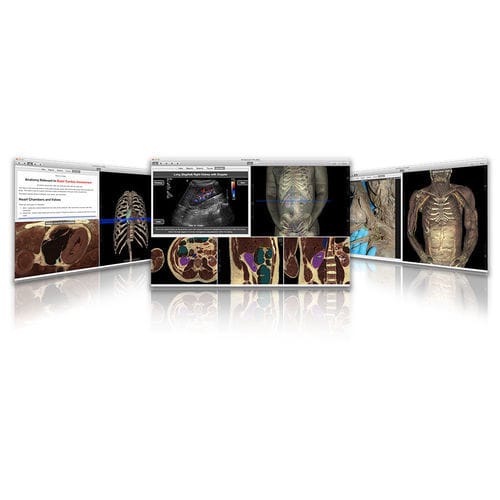 Ausbildungssoftware - VH Dissector - Touch of Life Technologies (ToLTech) - Anatomie