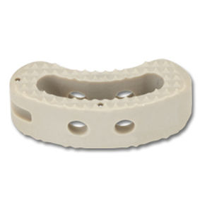 LWS-Zwischenwirbelimplantat - Shurfit™ TLIF - Precision Spine - transforaminaler Zugang / aus PEEK