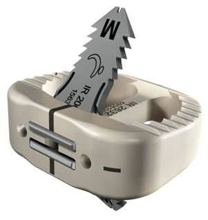 LWS-Zwischenwirbelimplantat - ROI-A®  - LDR Medical - ventraler Zugang / aus PEEK